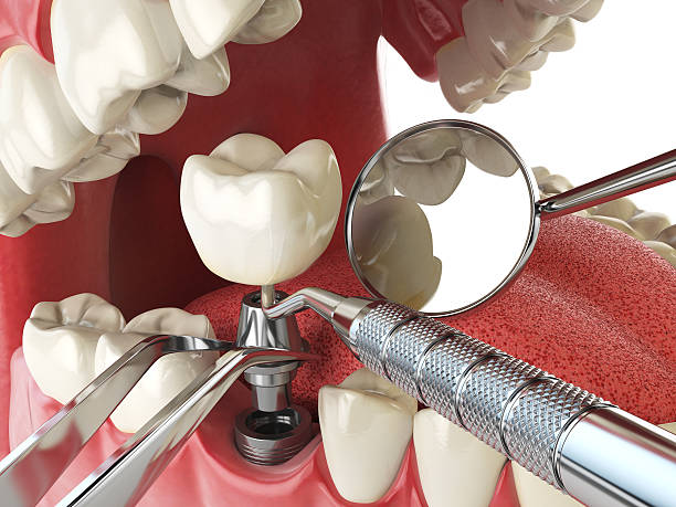 Best Emergency Treatment for Toothache in Henning, TN